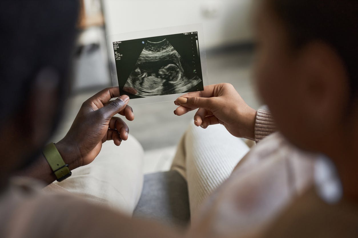 Close up of man and woman holding ultrasound picture together