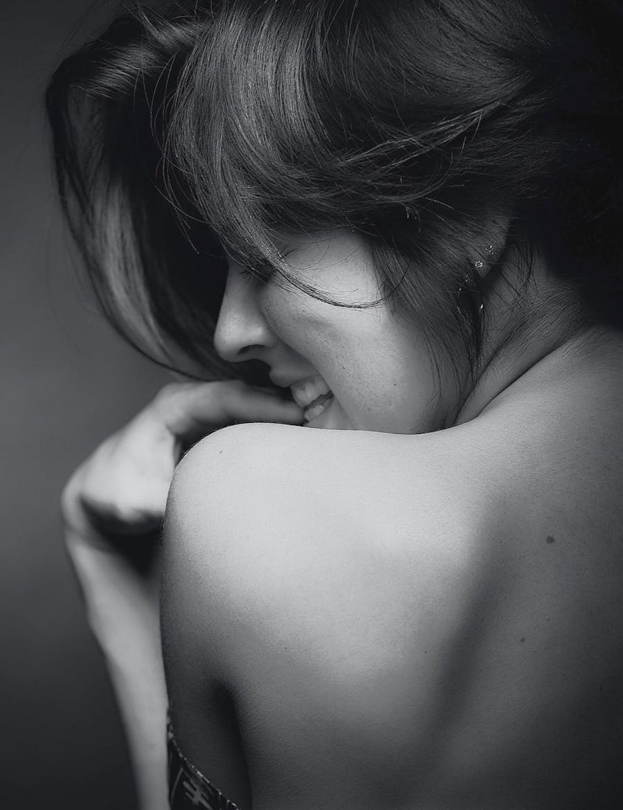 Model with smooth skin from Radiesse