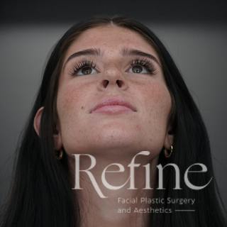 Rhinoplasty Before & After Gallery - Patient 244241 - Image 8