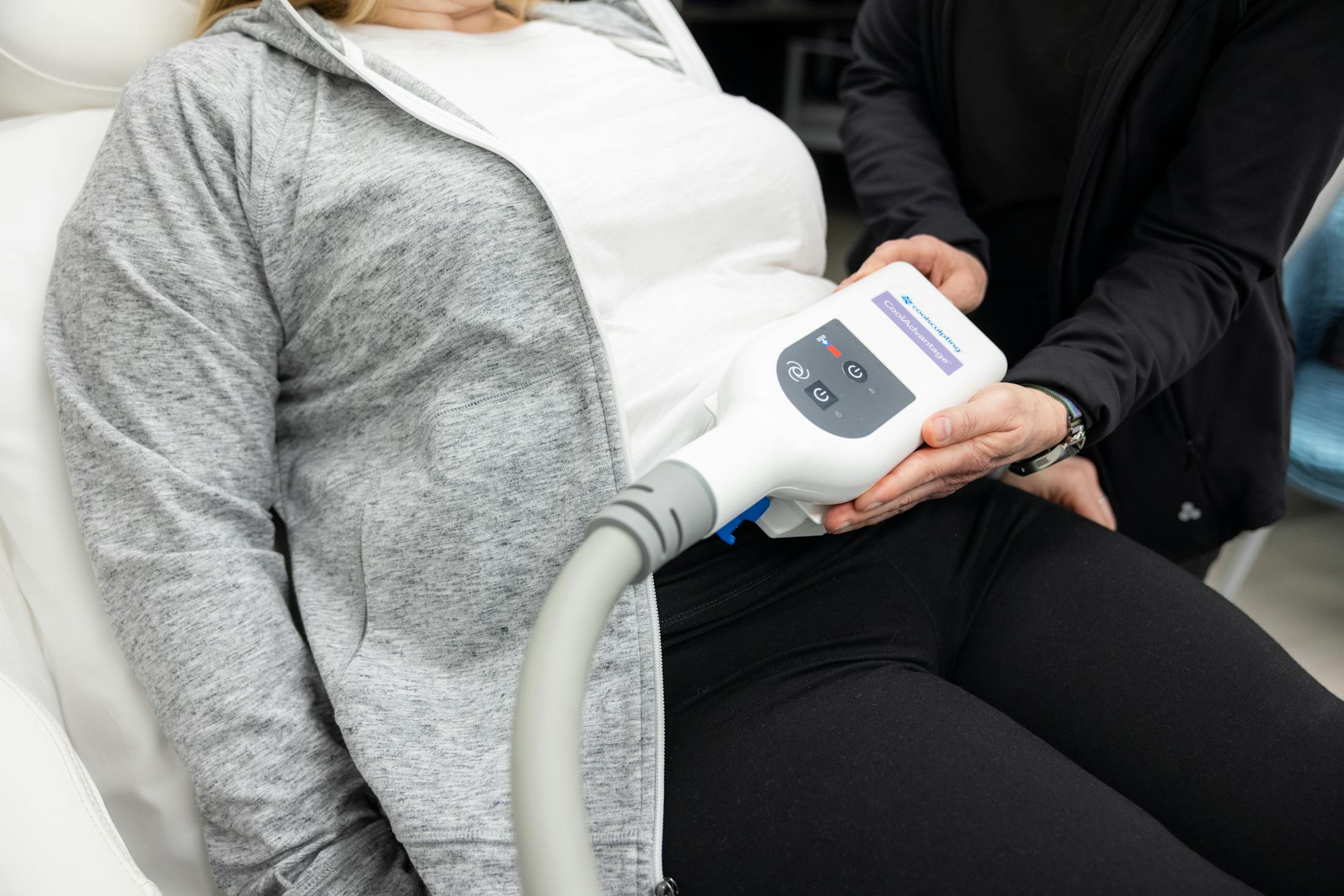 Women receiving Coolsculpting treatment