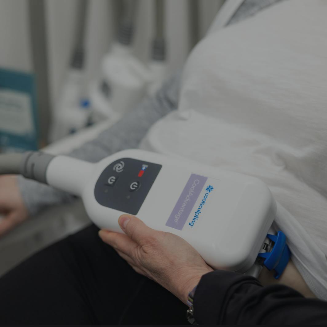 Women receiving Coolsculpting treatment