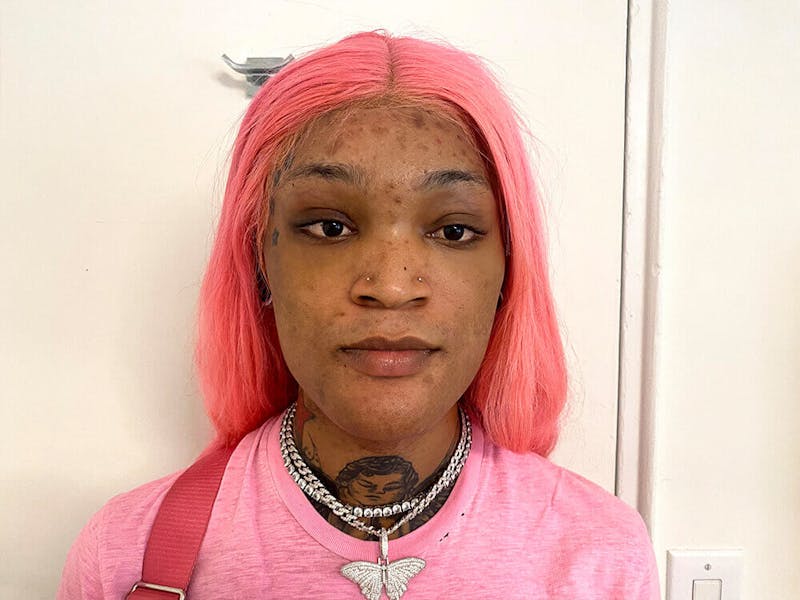 Case Studies Before & After Gallery - Patient 212472 - Image 1