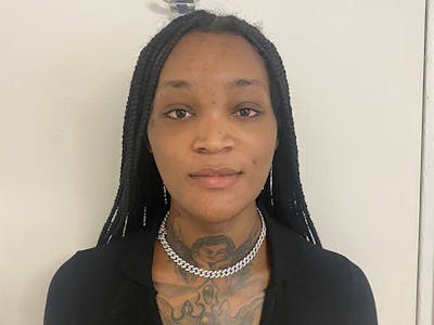 Case Studies Before & After Gallery - Patient 212472 - Image 2