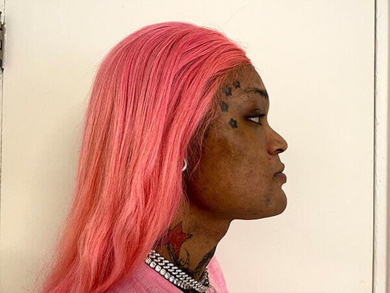 Case Studies Before & After Gallery - Patient 212472 - Image 5