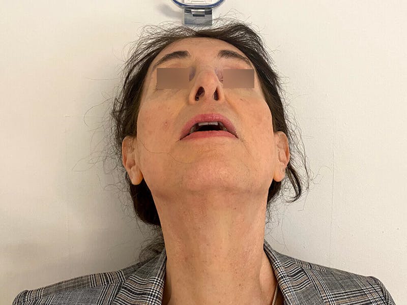 Case Studies Before & After Gallery - Patient 197338 - Image 5