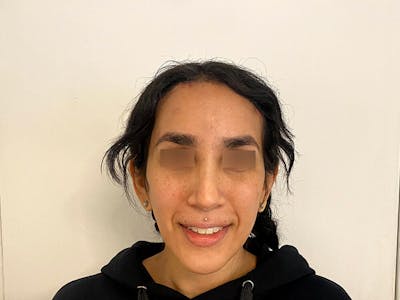 Case Studies Before & After Gallery - Patient 206183 - Image 1