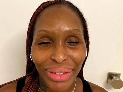 Case Studies Before & After Gallery - Patient 920765 - Image 2