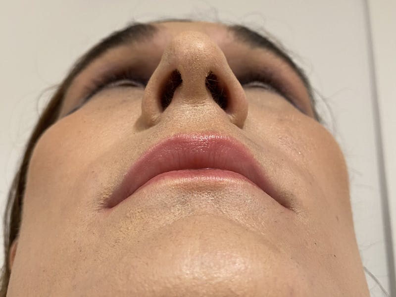 Case Studies Before & After Gallery - Patient 106009 - Image 9