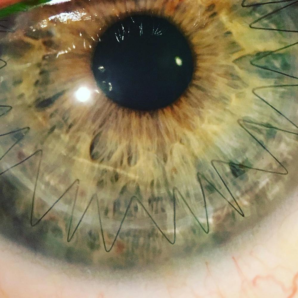eye