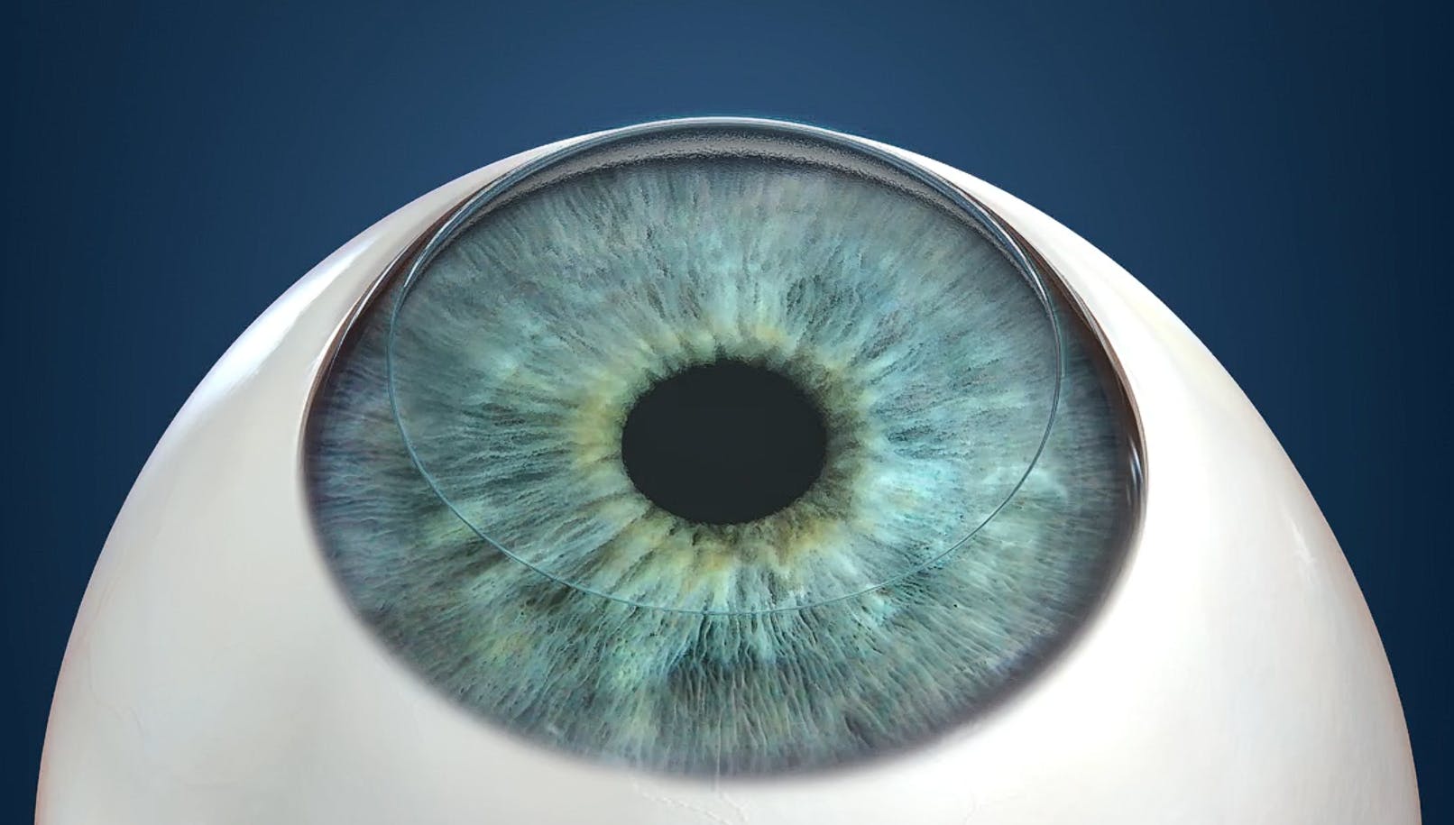 Step Two: Preparing the Surface of the Eye