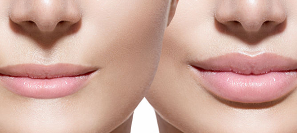 Vail Valley Plastic Surgery and Skin Care Blog | What Is Lip Enhancement And Is It Right For Me?