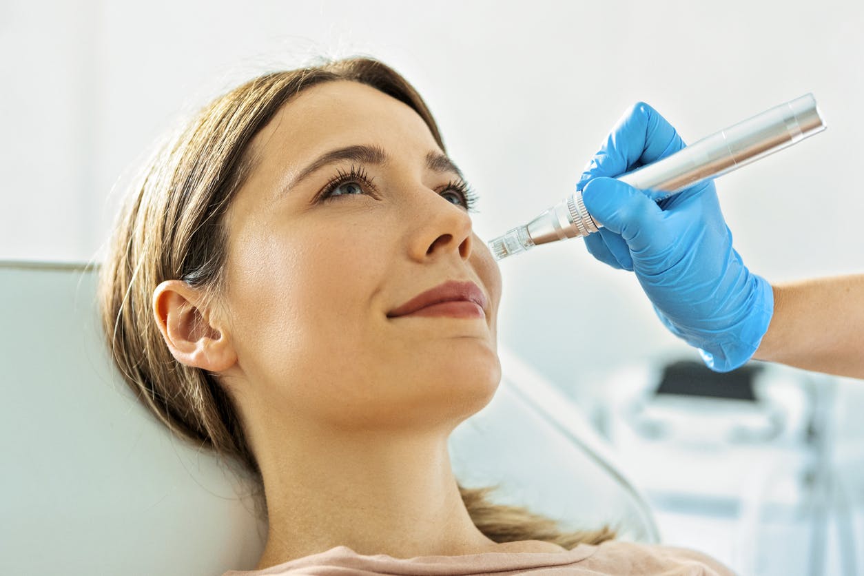 Woman receiving mirconeedling