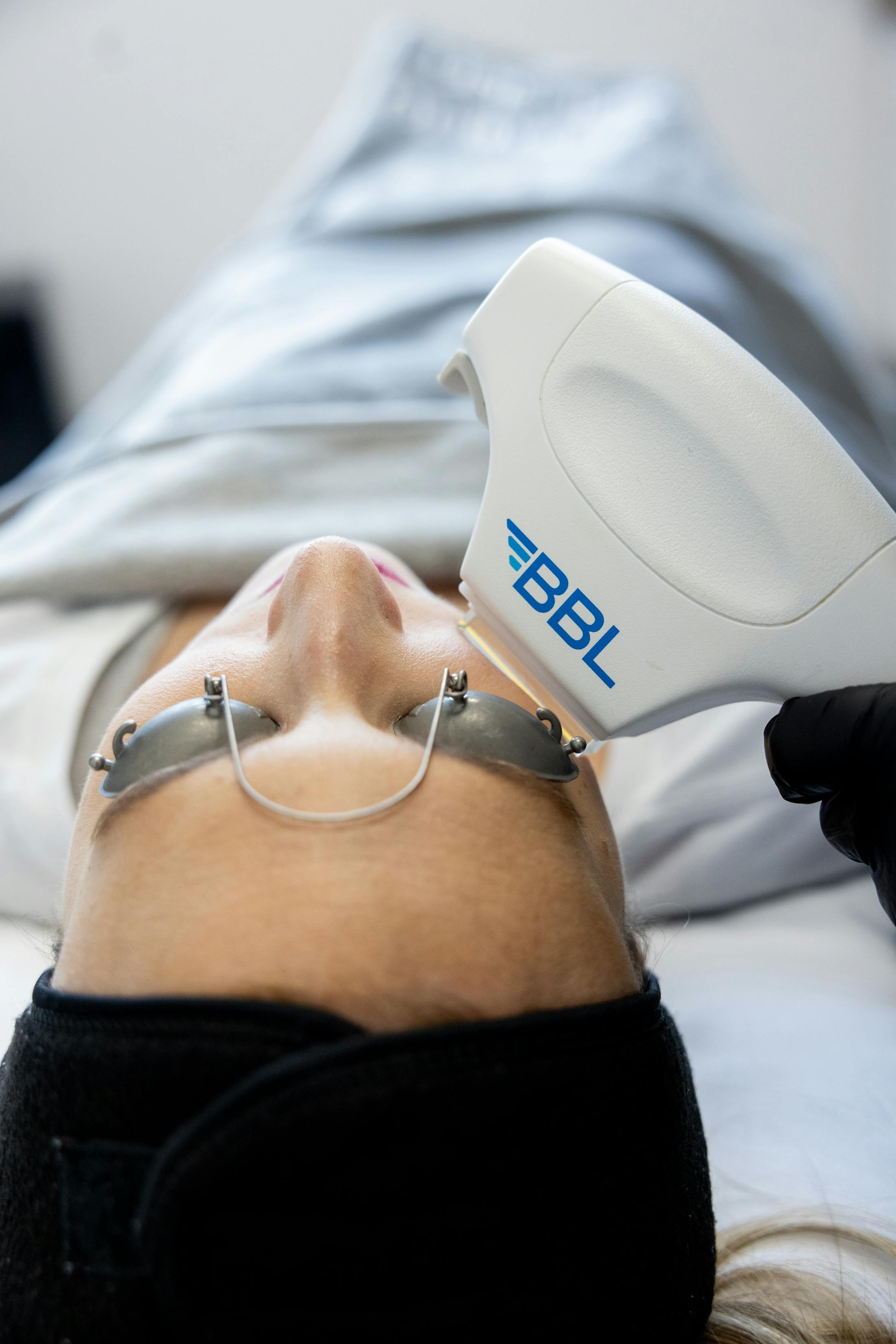 Women receiving a BBL laser treatment