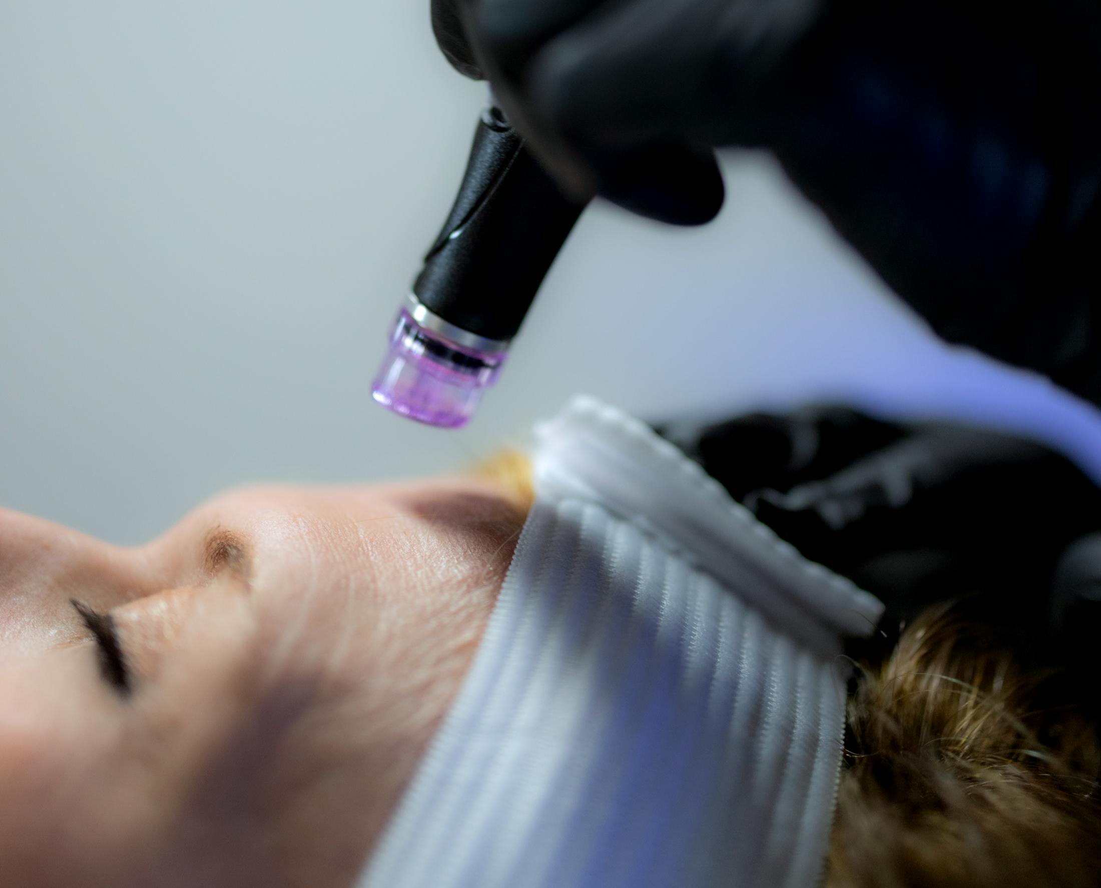 Close-up of Hydrafacial treatment being performed