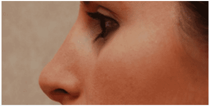 profile of woman's nose