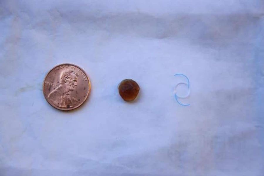 size-comparison photo