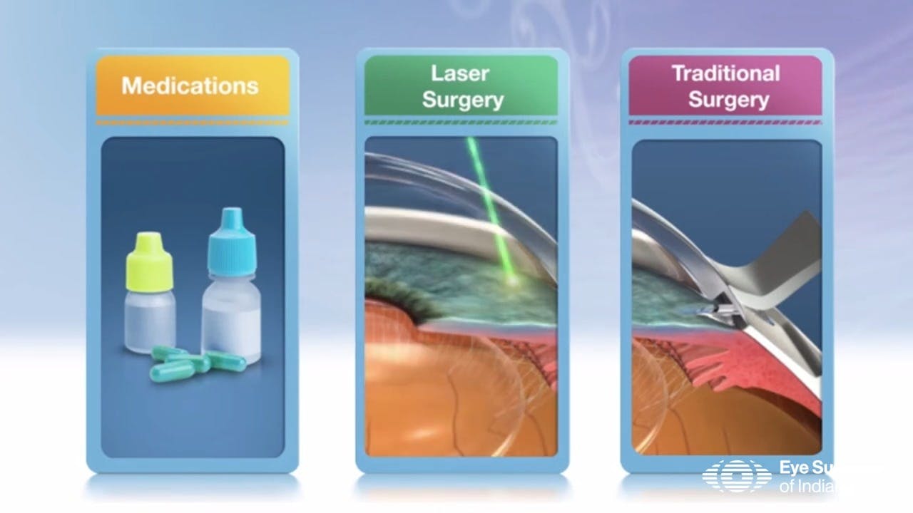 Eye Surgeons of Indiana