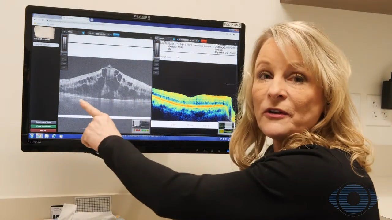 Eye Surgeons of Indiana