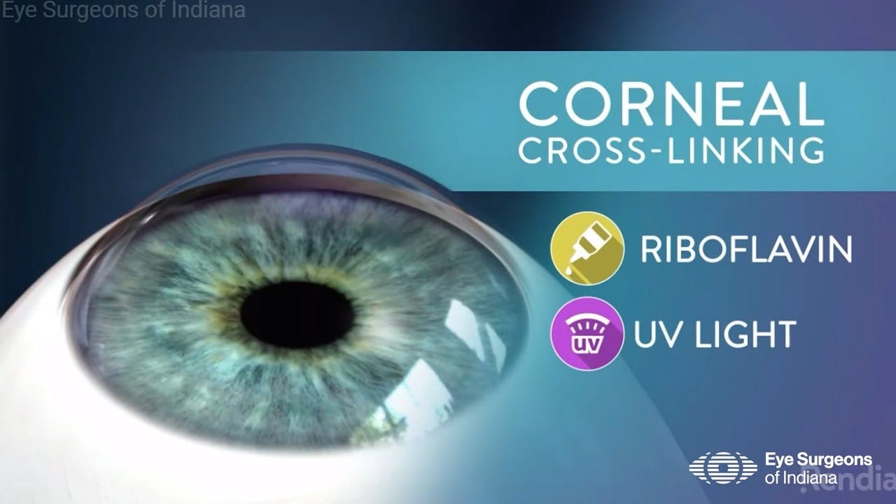 Eye Surgeons of Indiana