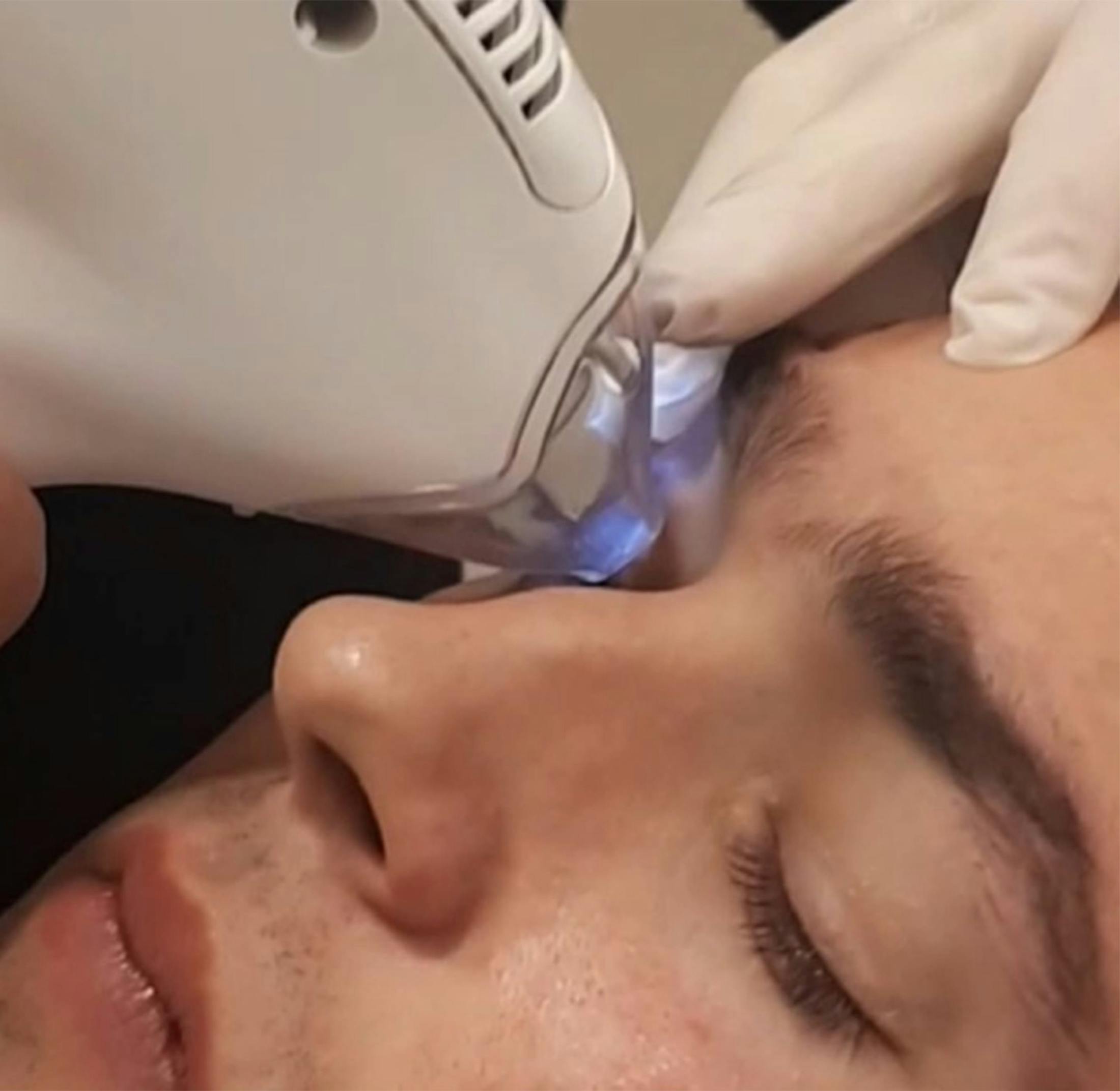 woman getting a procedure done