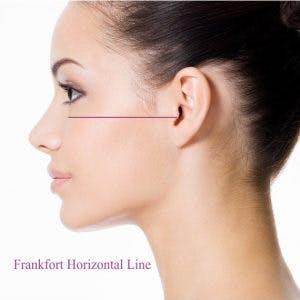 Frankfort horizontal line