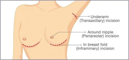 Anatomy of woman's breast