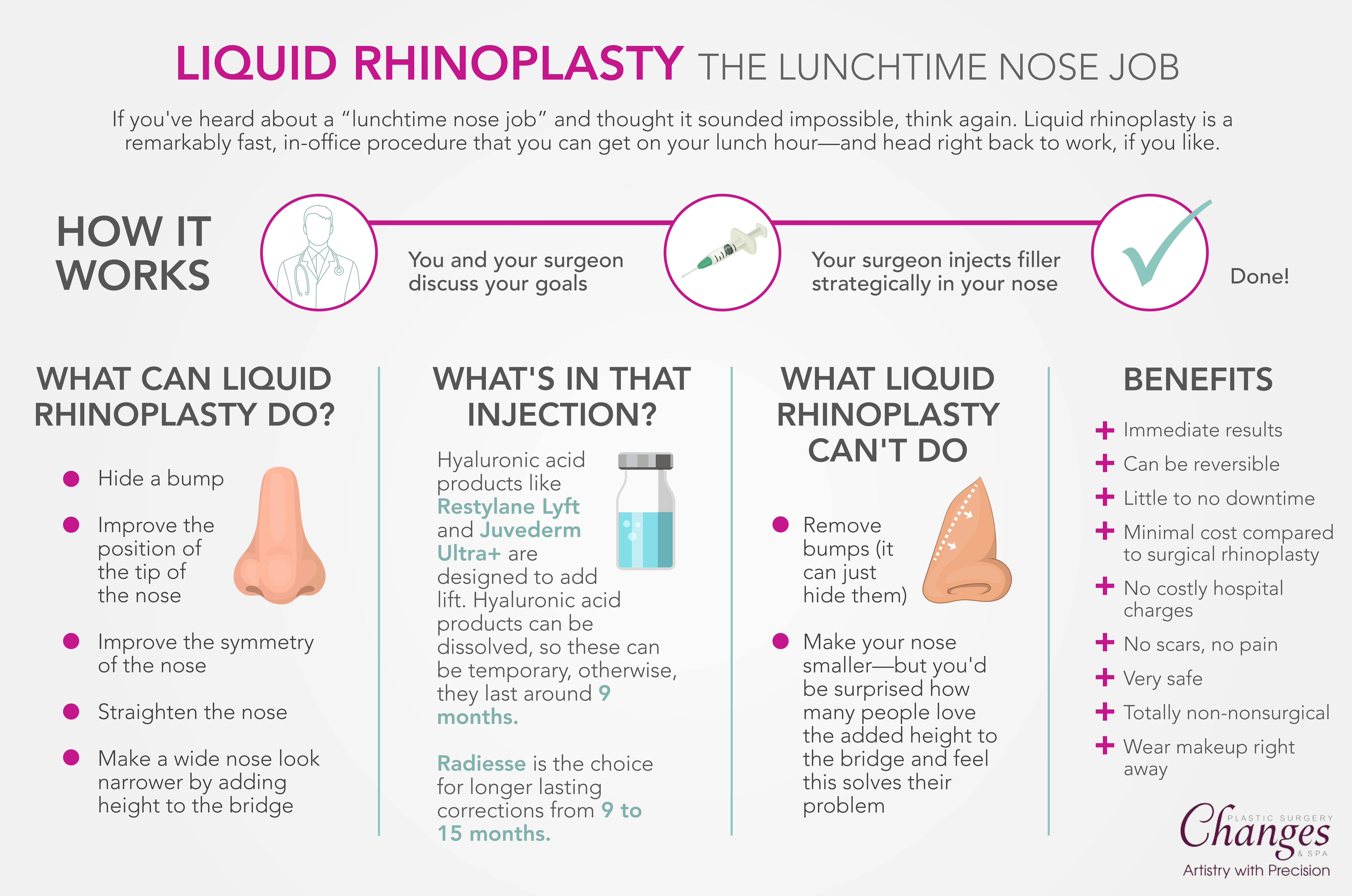 Liquid rhinoplasty infographic