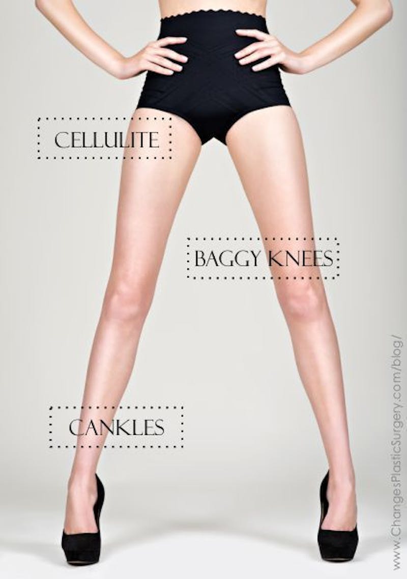 Woman standing with hands on her hips