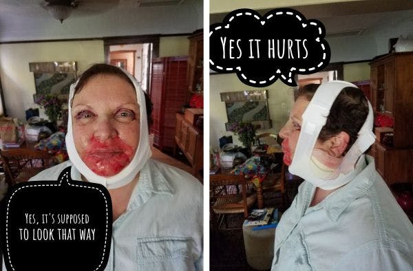 Patient after surgery