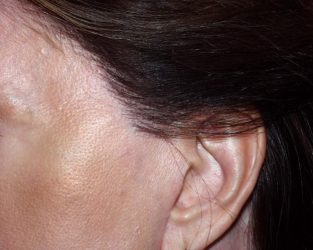 woman with missing sideburns