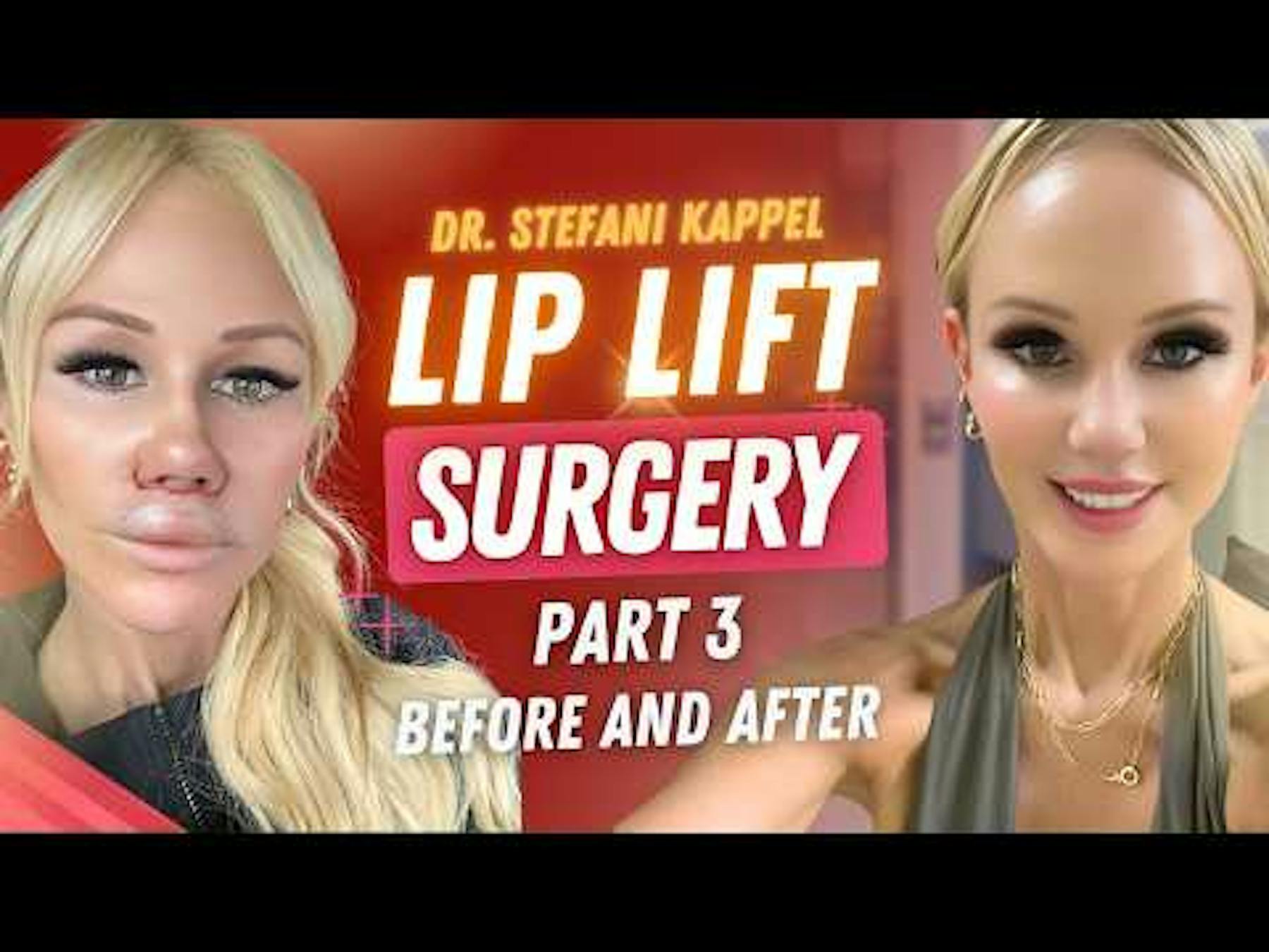 Changes Plastic Surgery