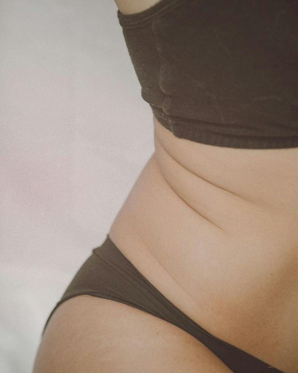 Flatten Your Belly Fast With A Tummy Tuck