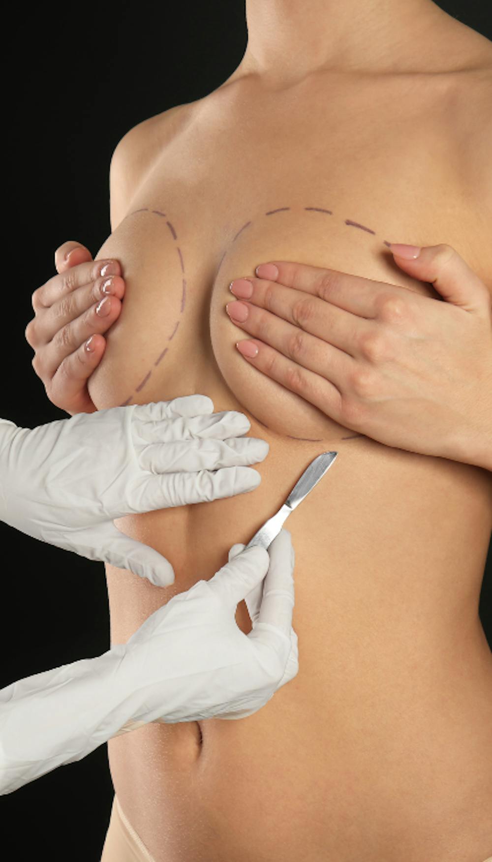 Breast Augmentation Post Motherhood Reclaiming Your Body With Dr. Effie Politis