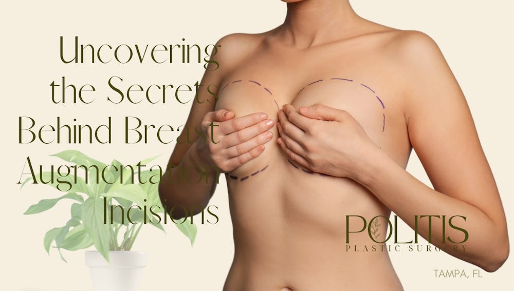 Uncovering The Secrets Behind Breast Augmentation Incisions