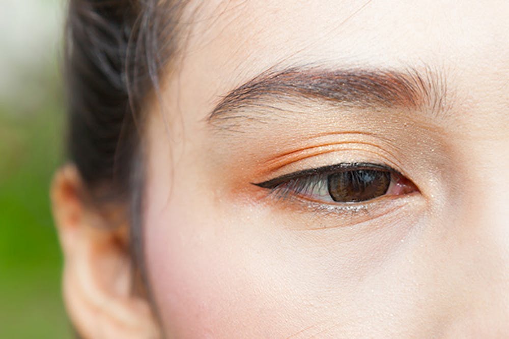 Blepharoplasty