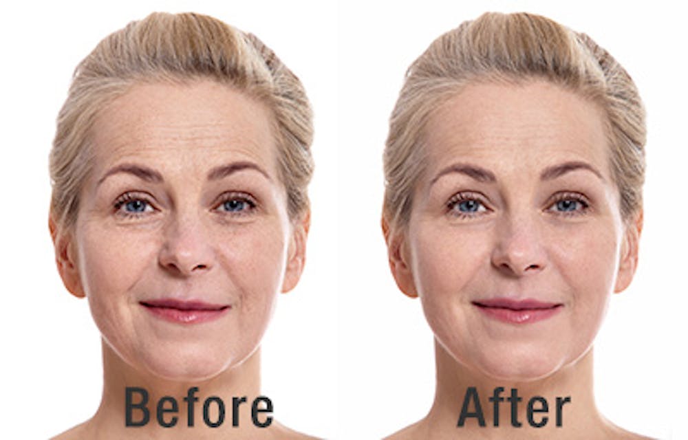 Plastic Surgery Benefits