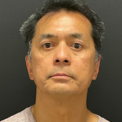 Upper & Lower Blepharoplasty Before & After Gallery - Patient 232066 - Image 1