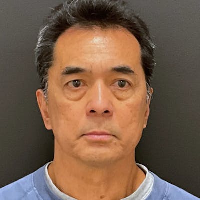 Upper & Lower Blepharoplasty Before & After Gallery - Patient 232066 - Image 2