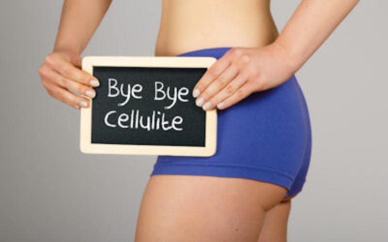 woman in blue shorts holding a blackboard with the words bye bye cellulite