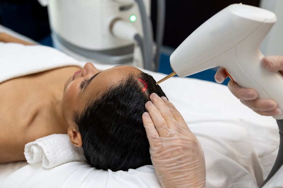 Woman recieving a Fotona Er: YAG hair restoration