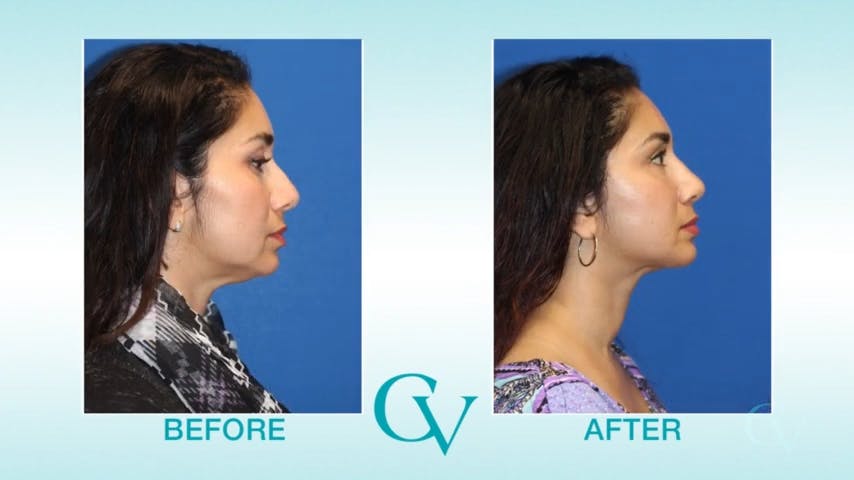 youtube screen shot vertical prevent