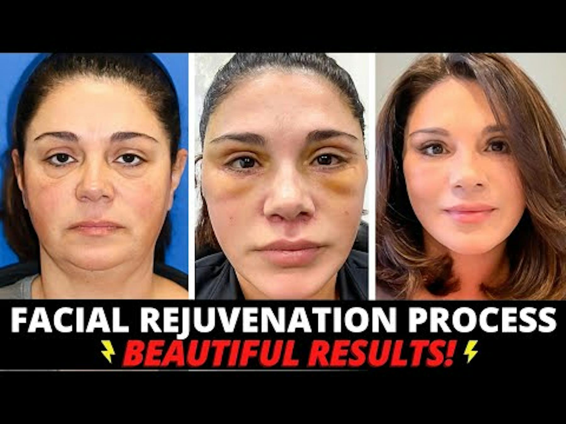 Carmel Valley Plastic Surgery