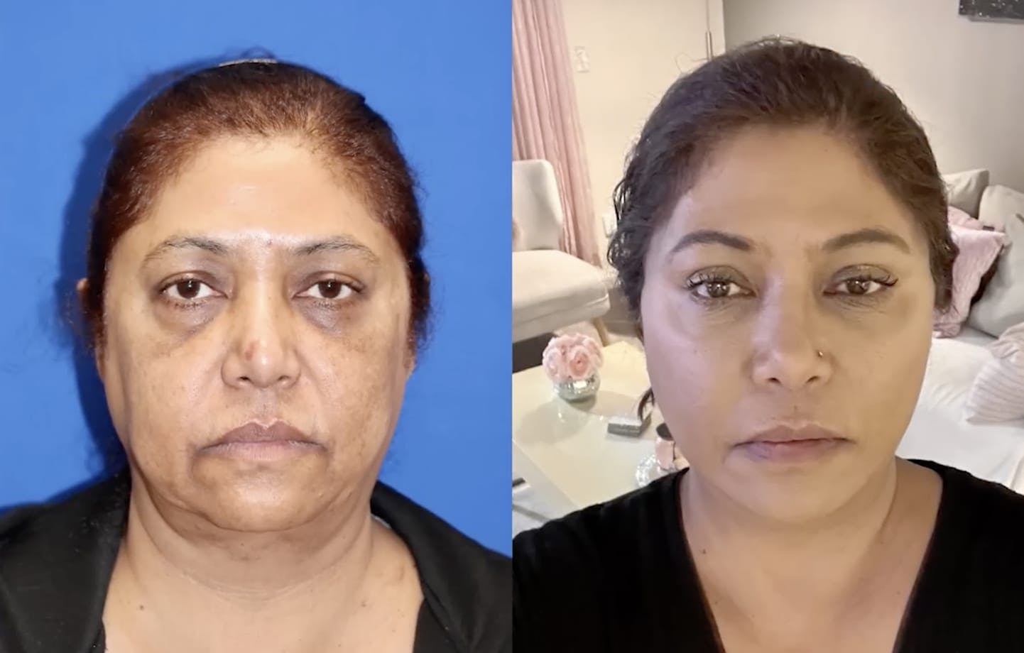 Carmel Valley Plastic Surgery