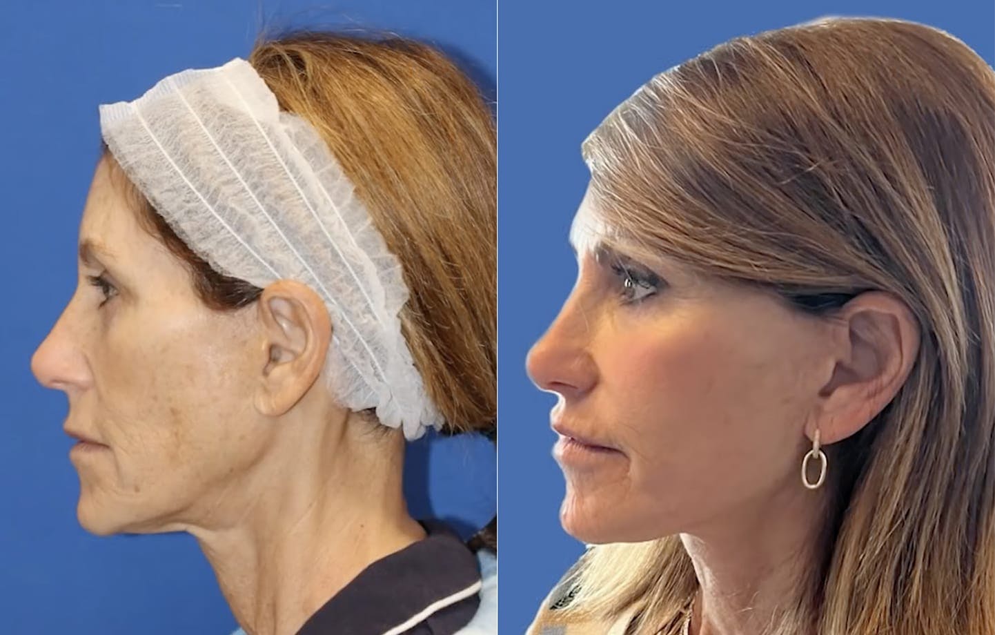 Carmel Valley Plastic Surgery