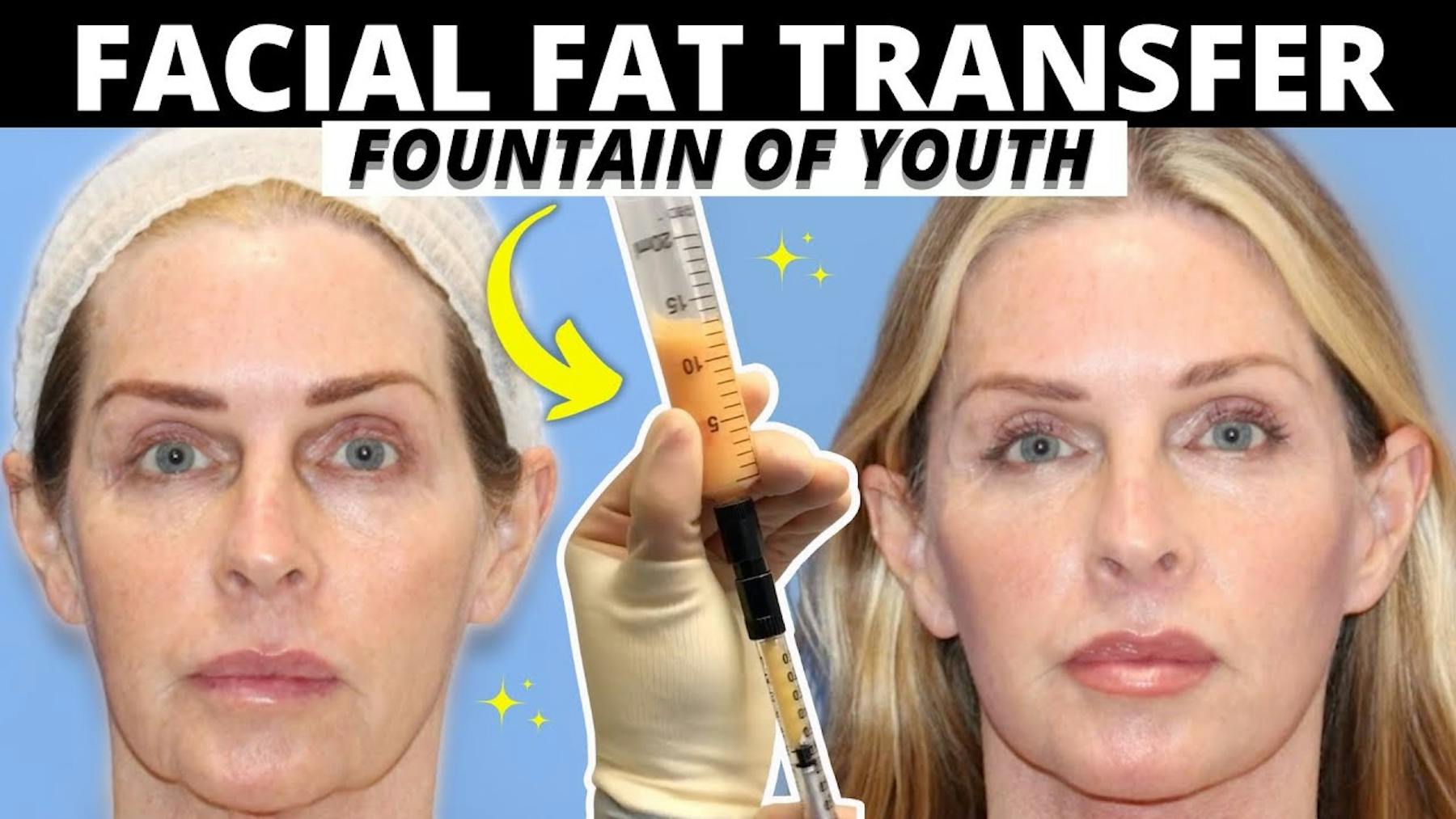 Carmel Valley Plastic Surgery