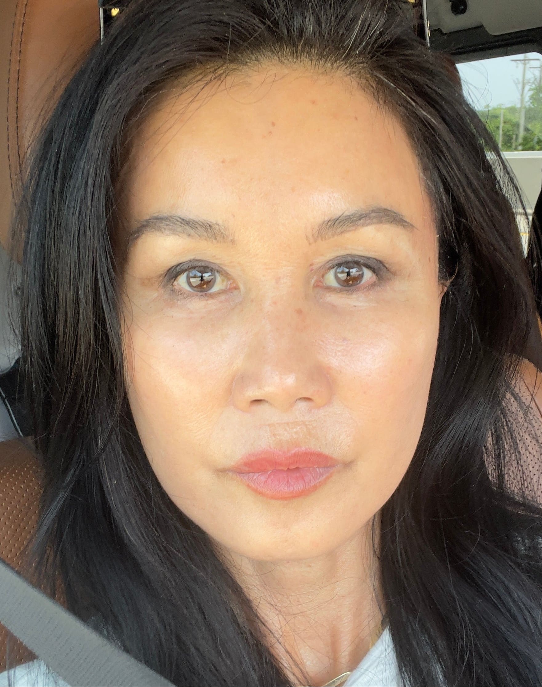 Jamie at age 60 following facial rejuvenation