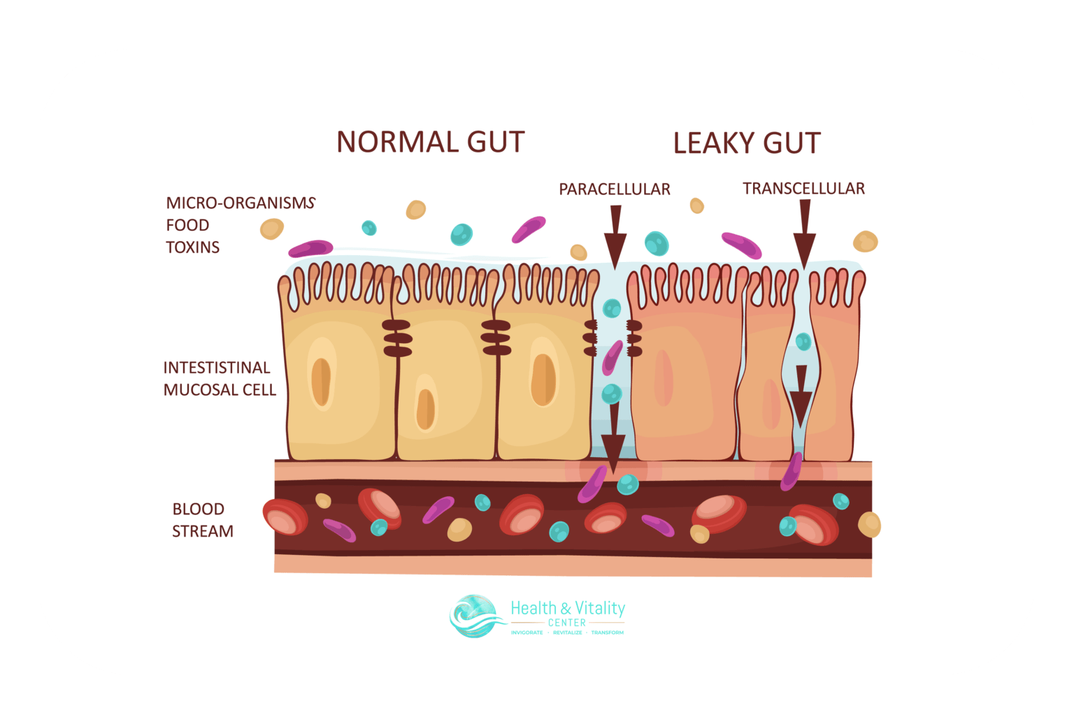 Autoimmune disease infographic