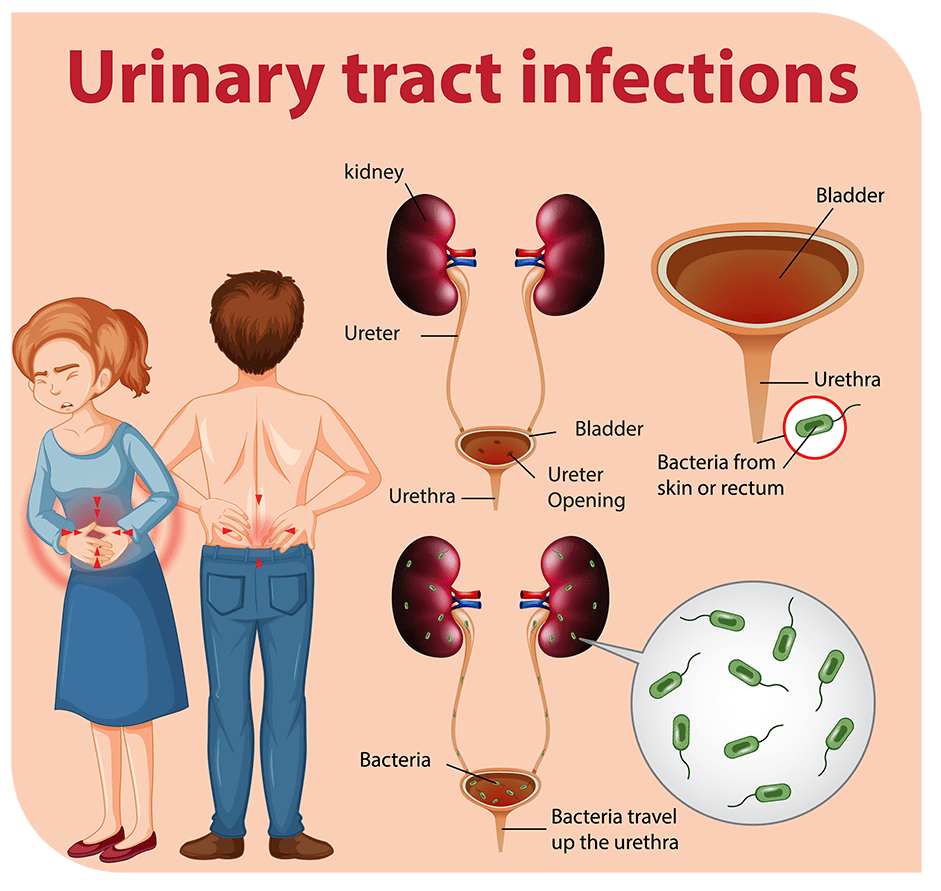 uti infographic