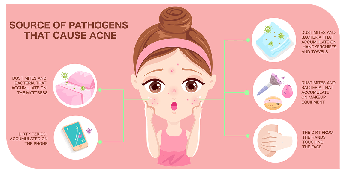 acne infographic