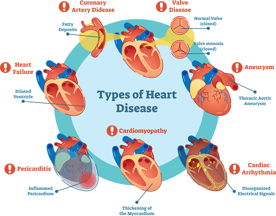 Types of Heart Disease infographic